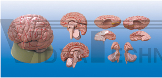 The model of brain and cerebral arteries distributing